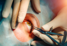 Eye Hospital vs. Eye Clinic: Which One Should You Visit?