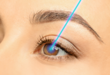 LASIK vs. Other Vision Correction Options: Which One Is Right for You?