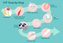 How to Choose the Right IVF Specialist for Your Fertility Needs