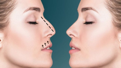 Why Rhinoplasty Is Becoming Popular Among Millennials