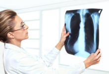 Pulmonologist vs. General Physician: What’s the Difference?