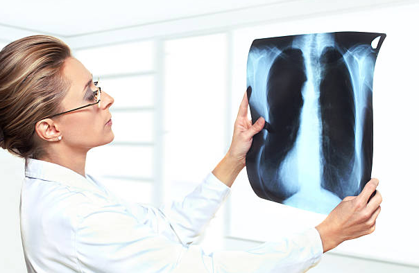 Pulmonologist vs. General Physician: What’s the Difference?