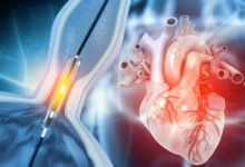 Early Signs of Heart Disease You Should Never Ignore